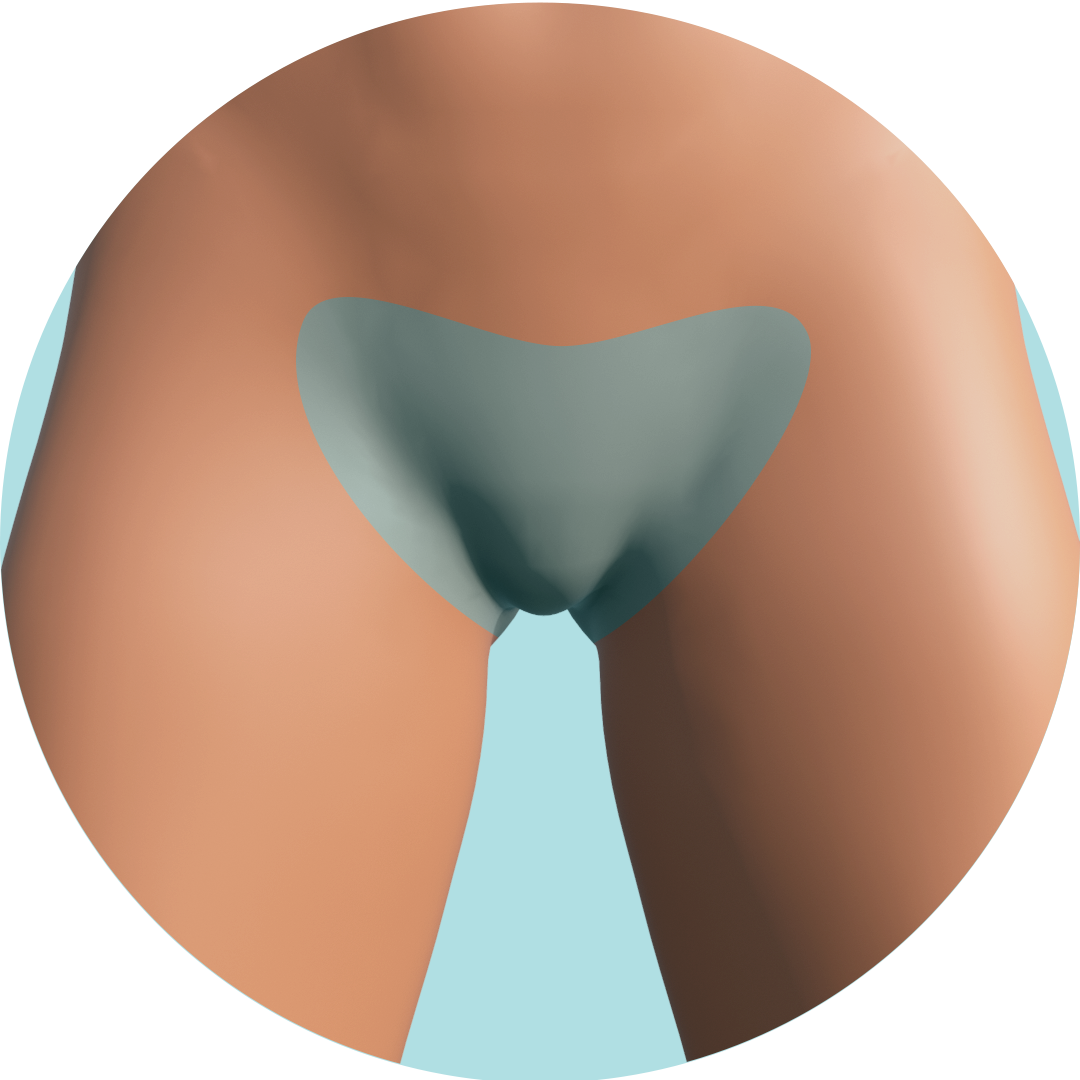 Depilación láser zona mediana 5 sesiones